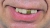 Teeth Glow Gold Miner